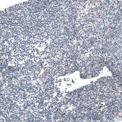 Invitrogen LAPTM4B Monoclonal Antibody (CL5289) 100 &mu;L; Unconjugated:Antibodies,