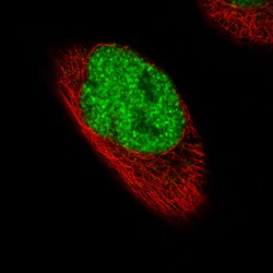 Invitrogen FOXP2 Monoclonal Antibody (CL5312) 100 &mu;L; Unconjugated:Antibodies,