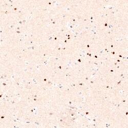 Invitrogen FOXP2 Monoclonal Antibody (CL5312) 100 &mu;L; Unconjugated:Antibodies,