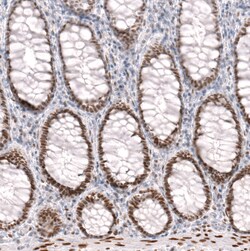 Invitrogen FOXP2 Monoclonal Antibody (CL5312) 100 &mu;L; Unconjugated:Antibodies,