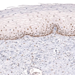 Invitrogen FOXP2 Monoclonal Antibody (CL5312) 100 &mu;L; Unconjugated:Antibodies,