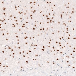 Invitrogen FOXP2 Monoclonal Antibody (CL5312) 100 &mu;L; Unconjugated:Antibodies,