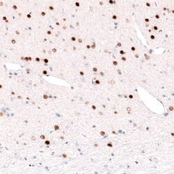 Invitrogen FOXP2 Monoclonal Antibody (CL5312) 100 &mu;L; Unconjugated:Antibodies,