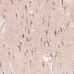 Invitrogen CTGF Monoclonal Antibody (CL5339) 100 &mu;L; Unconjugated:Antibodies,