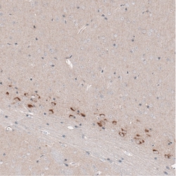 Invitrogen CTGF Monoclonal Antibody (CL5339) 100 &mu;L; Unconjugated:Antibodies,
