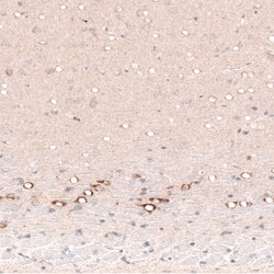 Invitrogen CTGF Monoclonal Antibody (CL5339) 100 &mu;L; Unconjugated:Antibodies,