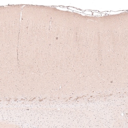Invitrogen CTGF Monoclonal Antibody (CL5339) 100 &mu;L; Unconjugated:Antibodies,