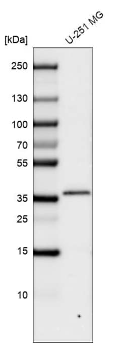 Invitrogen CTGF Monoclonal Antibody (CL5339) 100 &mu;L; Unconjugated:Antibodies,