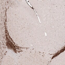 Invitrogen SOX4 Monoclonal Antibody (CL5634) 100 &mu;L; Unconjugated:Antibodies,