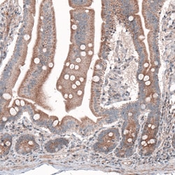 Invitrogen G6PC Monoclonal Antibody (CL5818) 100 &mu;L; Unconjugated:Antibodies,