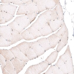 Invitrogen ROR2 Monoclonal Antibody (CL5950) 100 &mu;L; Unconjugated:Antibodies,