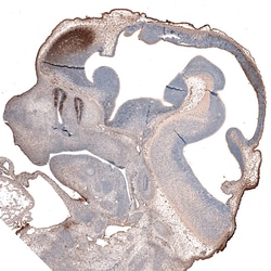 Invitrogen LHX2 Monoclonal Antibody (CL6137) 100 &mu;L; Unconjugated:Antibodies,