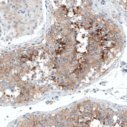 Invitrogen Sortilin Monoclonal Antibody (CL6528) 100 &mu;L; Unconjugated:Antibodies,