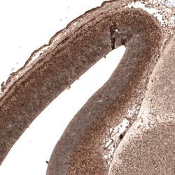 Invitrogen AUTS2 Monoclonal Antibody (CL7067) 100 &mu;L | Buy Online | Invitrogen&trade; | Fisher Scientific
