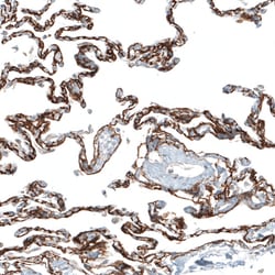 Invitrogen ITGA8 Monoclonal Antibody (CL7304) 100 &mu;L; Unconjugated:Antibodies,