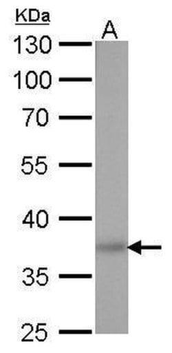 Invitrogen SOX2 Monoclonal Antibody (GT1352) 100 &mu;L; Unconjugated:Antibodies,
