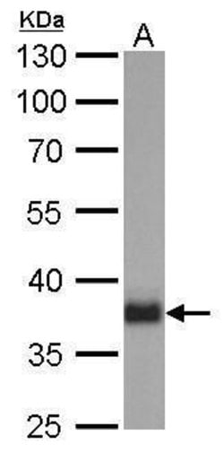 Invitrogen SOX2 Monoclonal Antibody (GT1352) 100 &mu;L; Unconjugated:Antibodies,