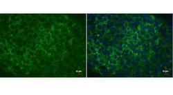 Invitrogen LIN28A Monoclonal Antibody (GT717) 100 &mu;L; Unconjugated:Antibodies,