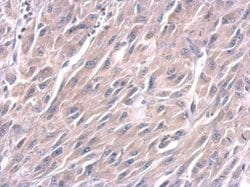 Invitrogen&trade;&nbsp;LIN28A Monoclonal Antibody (GT1086)