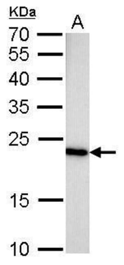Invitrogen GLO1 Monoclonal Antibody (GT552) 100 &mu;L; Unconjugated:Antibodies,