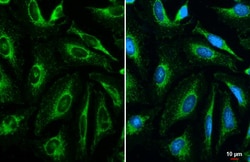 Invitrogen COX4 Monoclonal Antibody (GT854) 100 &mu;L; Unconjugated:Antibodies,