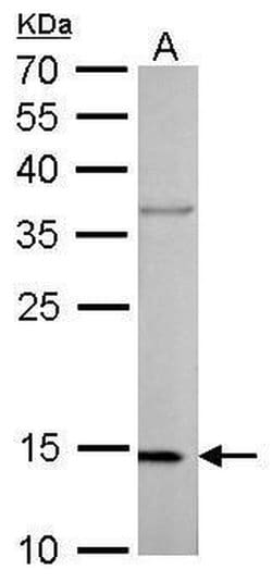 Invitrogen COX4 Monoclonal Antibody (GT854) 100 &mu;L; Unconjugated:Antibodies,