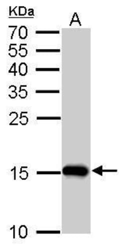 Invitrogen COX4 Monoclonal Antibody (GT854) 100 &mu;L; Unconjugated:Antibodies,