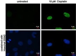 Invitrogen Phospho-Histone H2A (Ser139) Monoclonal Antibody (GT1021) 100