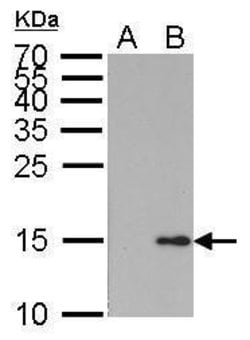 Invitrogen Phospho-Histone H2A (Ser139) Monoclonal Antibody (GT1021) 100