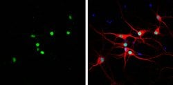 Invitrogen HMGB1 Monoclonal Antibody (GT412) 100 &mu;L; Unconjugated:Antibodies,