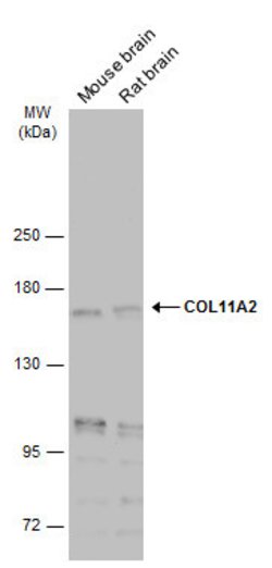 Invitrogen COL11A2 Monoclonal Antibody (GT212) 100 &mu;L; Unconjugated:Antibodies,