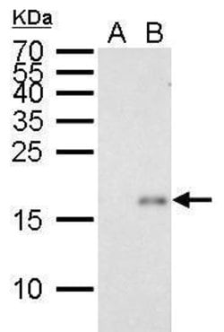 Invitrogen p21 Monoclonal Antibody (GT8611) 100 &mu;L; Unconjugated:Antibodies,