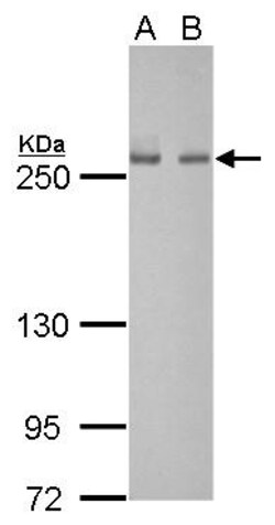 Invitrogen FASN Monoclonal Antibody (GT325) 100 &mu;L; Unconjugated:Antibodies,