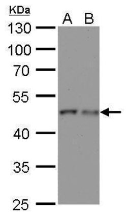 Invitrogen gamma Tubulin Monoclonal Antibody (GT4511) 100 &mu;L; Unconjugated:Antikörper