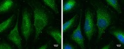 Invitrogen MX1 Monoclonal Antibody (GT4812) 100 &mu;L; Unconjugated:Antibodies,