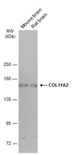 Invitrogen COL11A2 Monoclonal Antibody (GT6410) 100 &mu;L; Unconjugated:Antibodies,