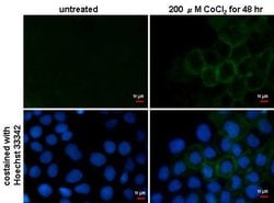 Invitrogen Carbonic Anhydrase IX Monoclonal Antibody (GT14212) 100 &mu;L;