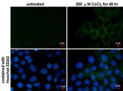 Invitrogen Carbonic Anhydrase IX Monoclonal Antibody (GT14212) 100 &mu;L;
