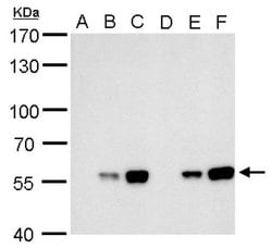 Invitrogen Carbonic Anhydrase IX Monoclonal Antibody (GT14212) 100 &mu;L;