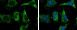 Invitrogen FASN Monoclonal Antibody (GT5210) 100 μL; Unconjugated:Antibodies,