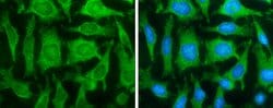 Invitrogen&trade;&nbsp;FASN Monoclonal Antibody (GT556)