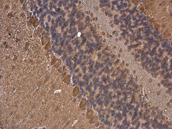 Invitrogen FASN Monoclonal Antibody (GT556) 100 &mu;L | Buy Online | Invitrogen&trade; | Fisher Scientific