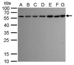 Invitrogen ATG12 Monoclonal Antibody (GT948) 100 &mu;L; Unconjugated:Antibodies,