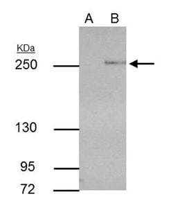 Invitrogen TET2 Monoclonal Antibody (GT442) 100 &mu;L; Unconjugated:Antibodies,