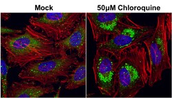 Invitrogen SQSTM1 Monoclonal Antibody (GT239) 100 &mu;L | Buy Online | Invitrogen&trade; | Fisher Scientific