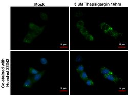 Invitrogen SQSTM1 Monoclonal Antibody (GT239) 100 &mu;L | Buy Online | Invitrogen&trade; | Fisher Scientific