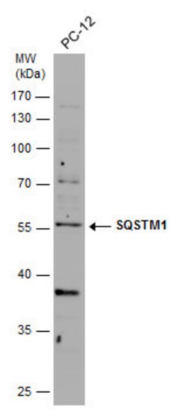 Invitrogen SQSTM1 Monoclonal Antibody (GT239) 100 &mu;L | Buy Online | Invitrogen&trade; | Fisher Scientific