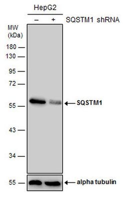 Invitrogen SQSTM1 Monoclonal Antibody (GT239) 100 &mu;L | Buy Online | Invitrogen&trade; | Fisher Scientific