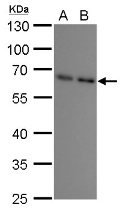 Invitrogen SQSTM1 Monoclonal Antibody (GT239) 100 &mu;L | Buy Online | Invitrogen&trade; | Fisher Scientific