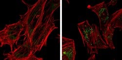 SQSTM1 Monoclonal Antibody (GT381), Invitrogen&trade;